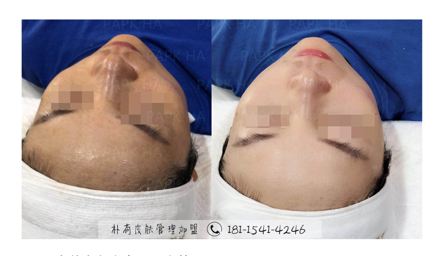 皮肤管理1 (19).jpg